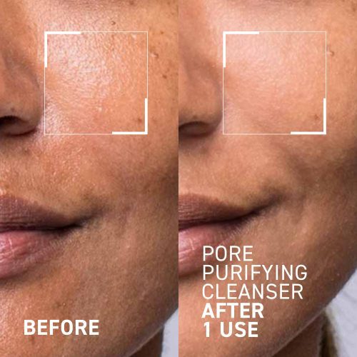 03 PNM POREPURIFYING CLEANSER PDP