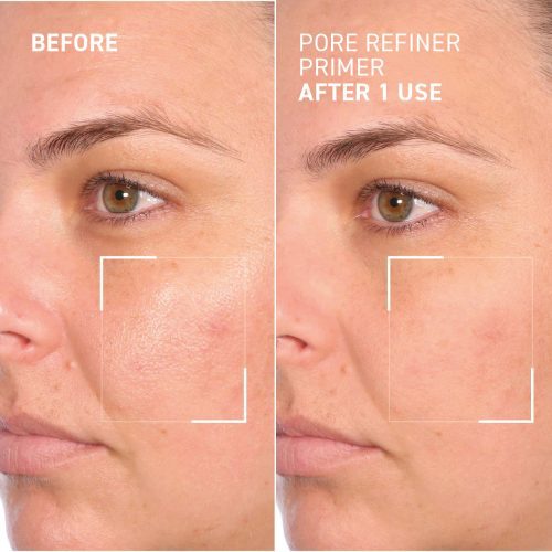 PNM PoreRefinerPrimer BefAft Asha side